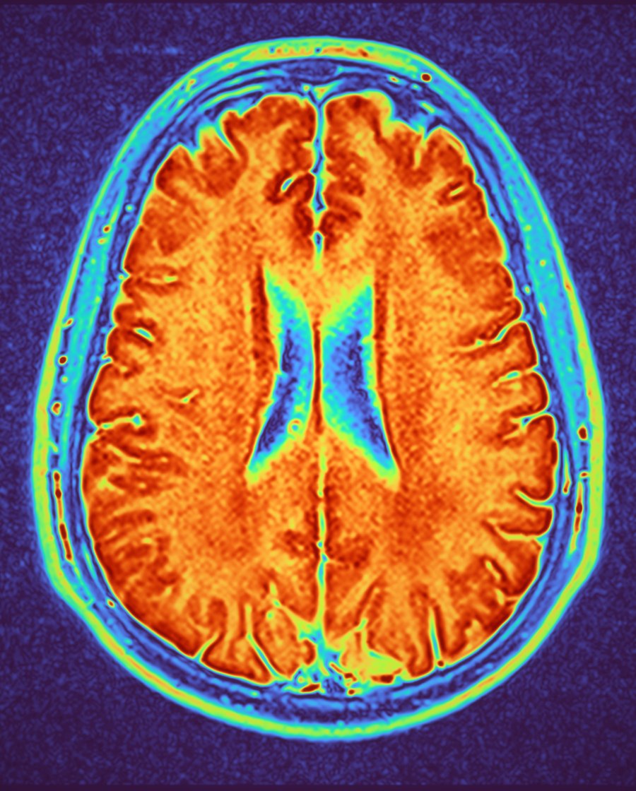 An infrared-toned axial scan artwork