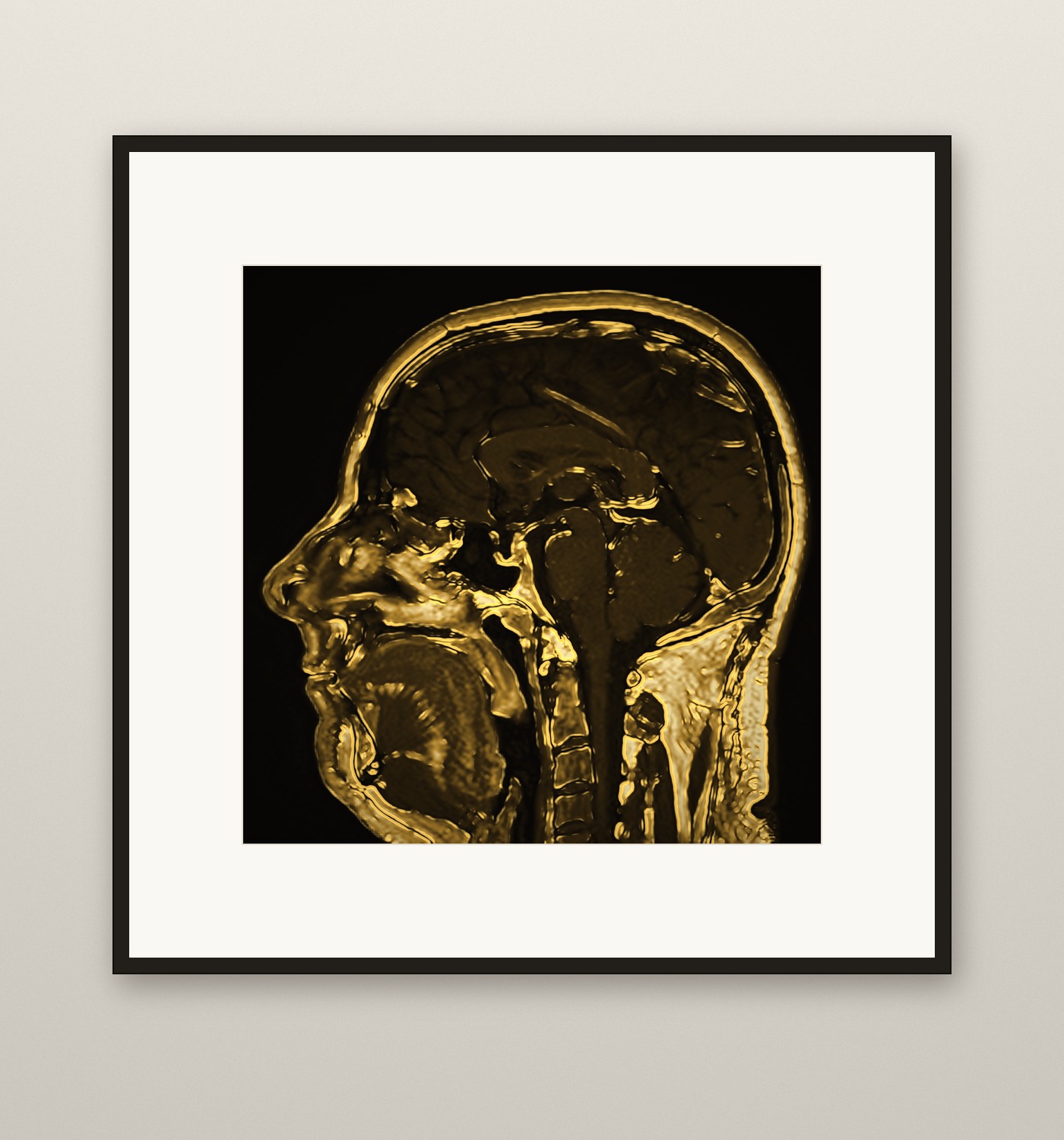 A framed gilded print of a mid-sagittal MRI