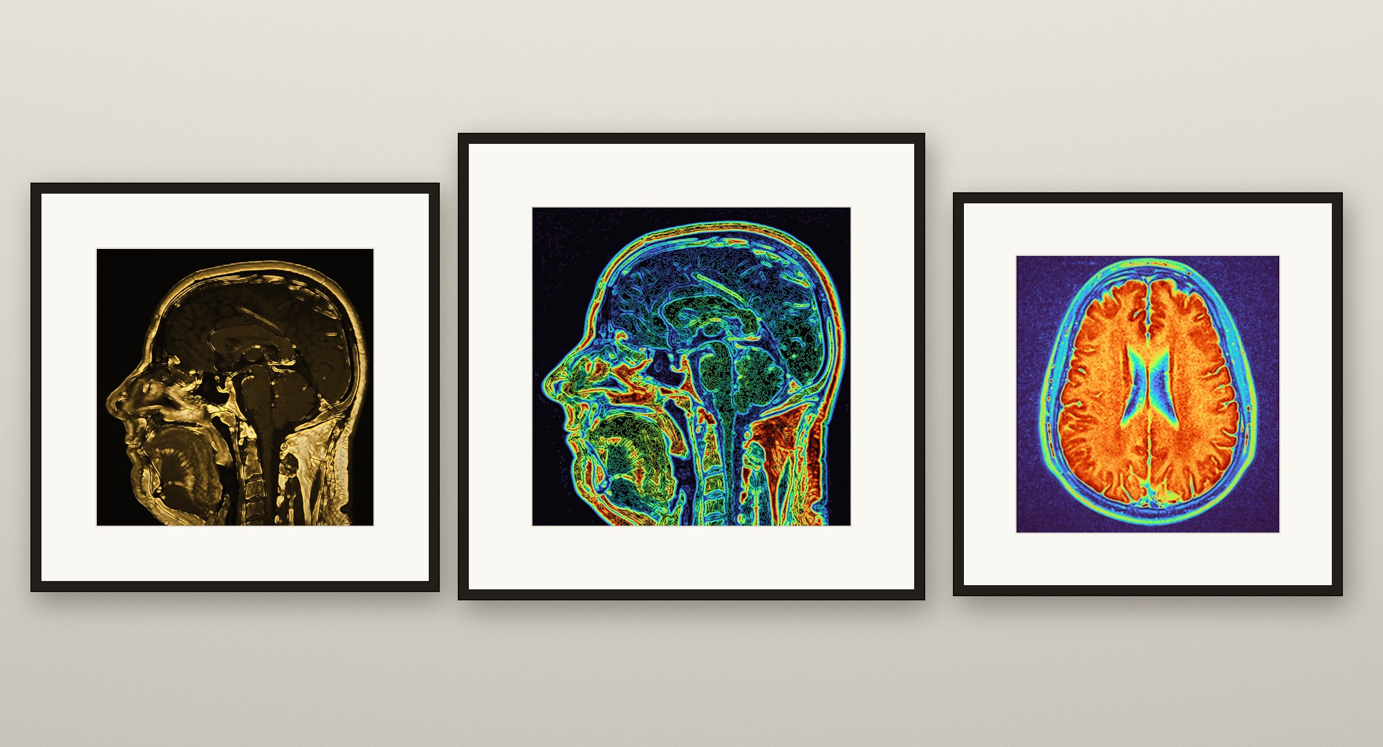 Three framed prints made from a brain MRI, hung on a gallery wall